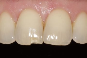 long per op cropped and straightened